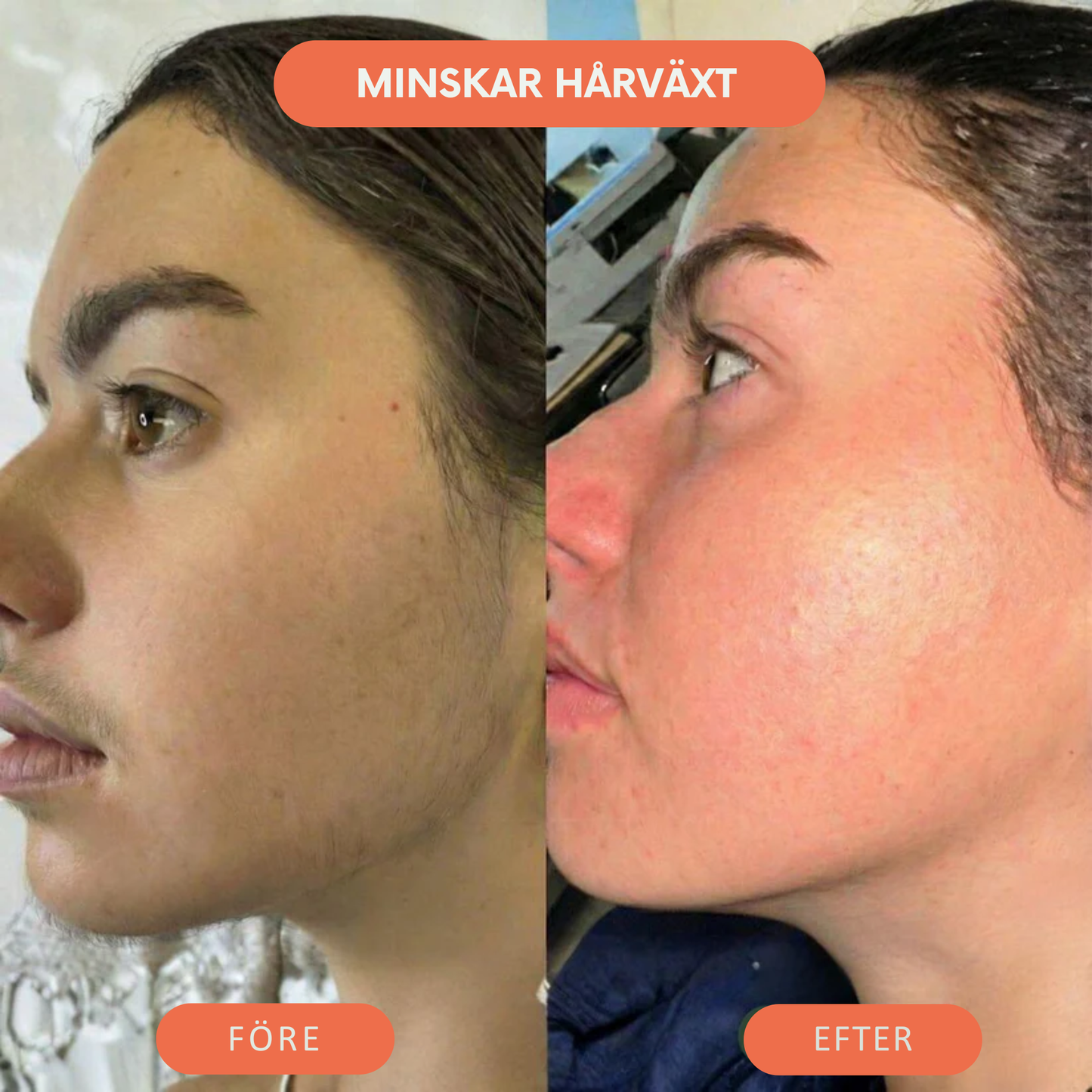 Deva™ Hårborttagningsolja – Naturligt len hud utan rakning