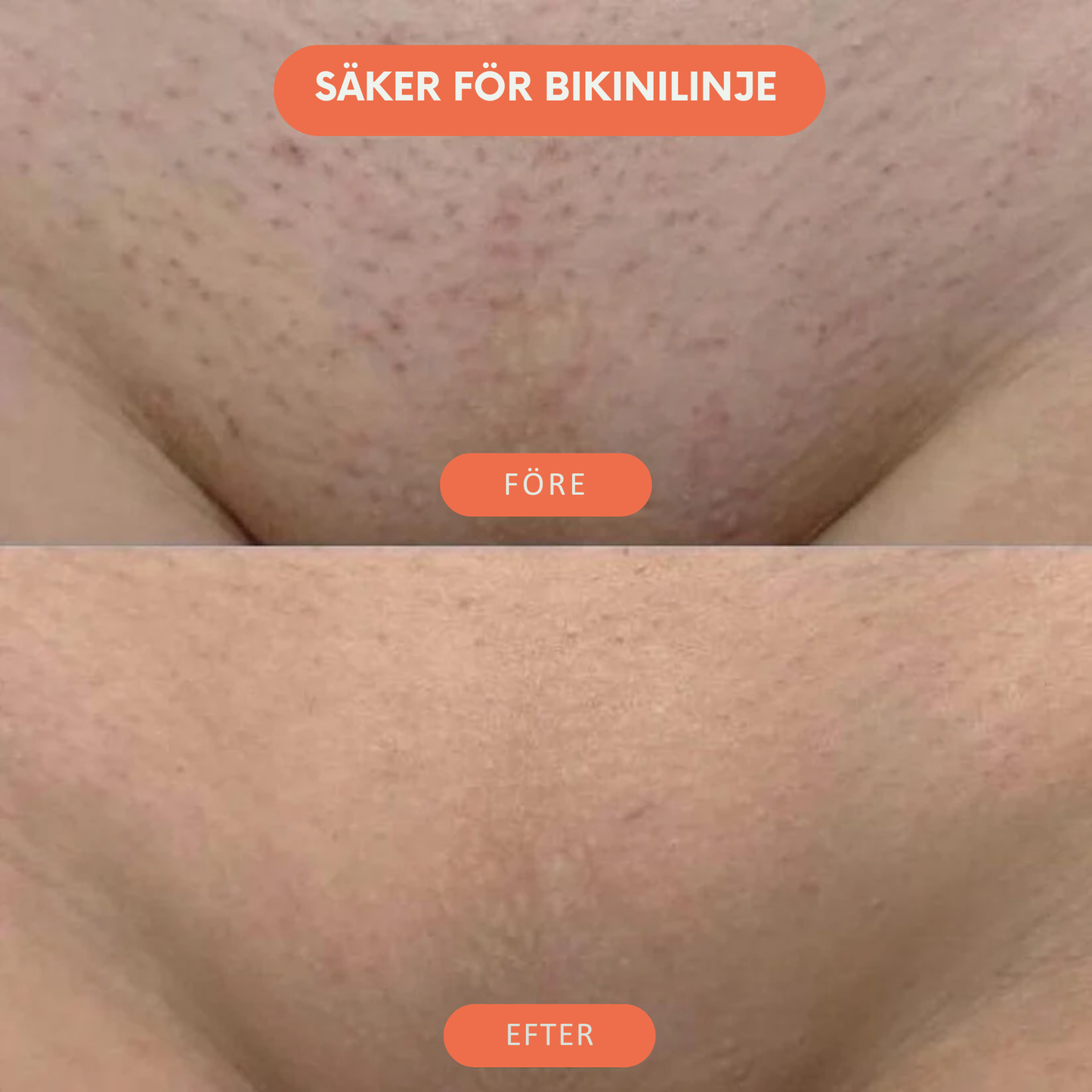 Deva™ Hårborttagningsolja – Naturligt len hud utan rakning