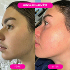 Deva™ Hårborttagningsolja – Naturligt len hud utan rakning