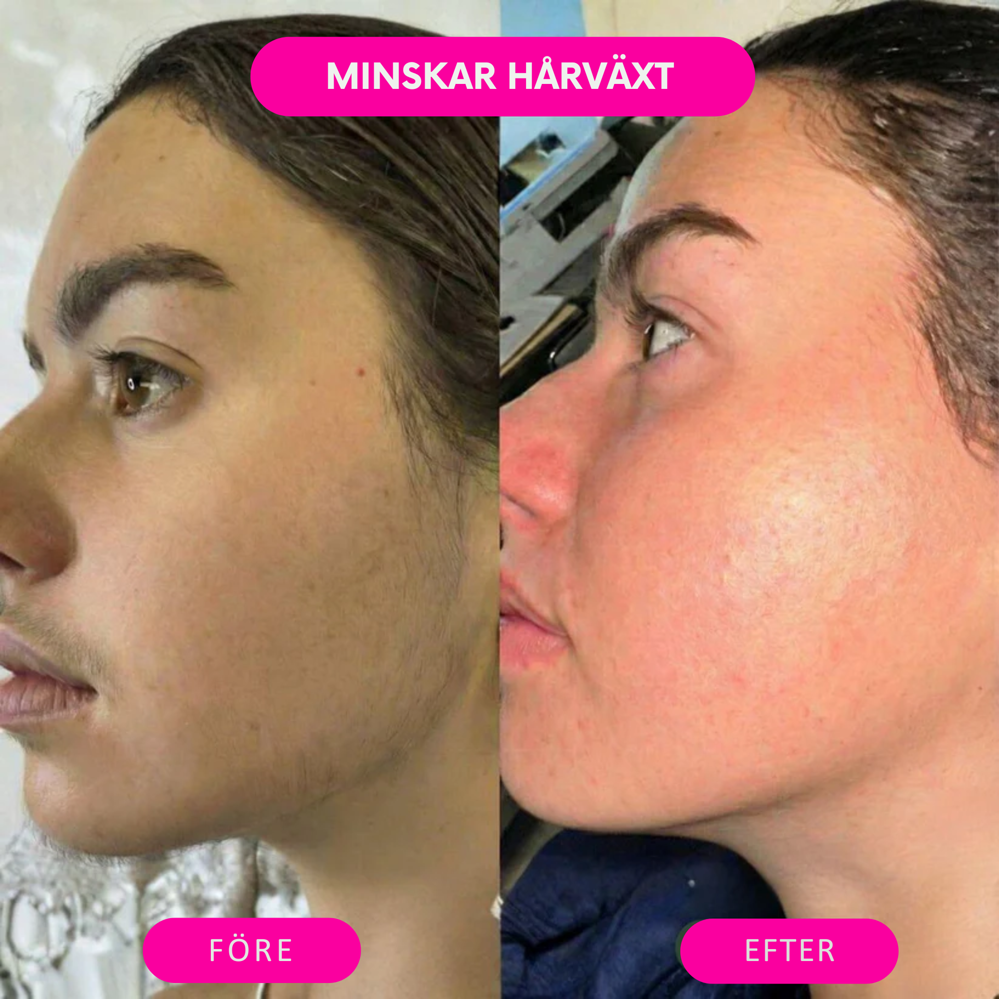 Deva™ Hårborttagningsolja – Naturligt len hud utan rakning